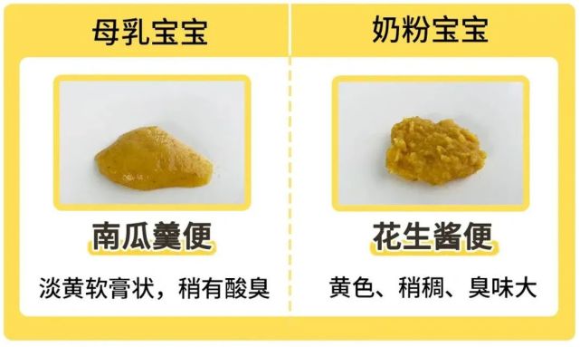 宝宝大便详解,若娃出现这种便便,赶紧就医!一刻