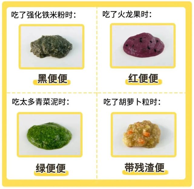 宝宝大便详解,若娃出现这种便便,赶紧就医!一刻