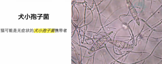 白癣黑点癣黄癣脓癣有何区别如何诊治