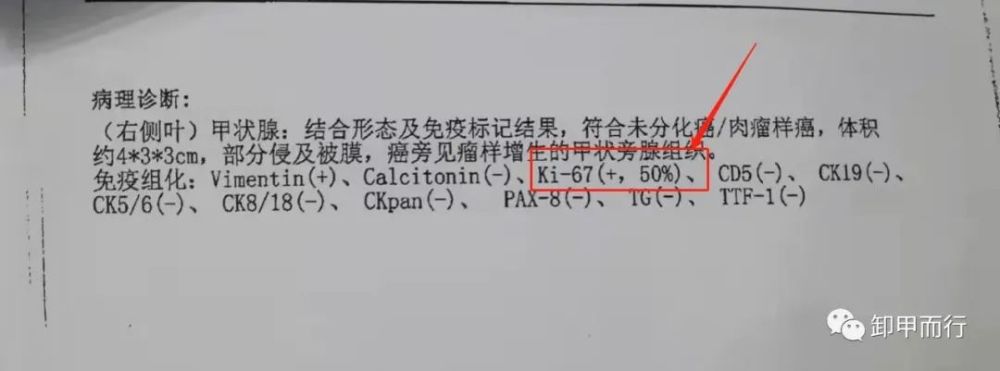 701甲状腺癌20种免疫组化标志物及其意义收藏版