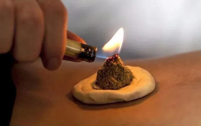 灸感是在做艾灸时感知的一种气的变化艾灸气至才有效怎样艾灸才有灸感