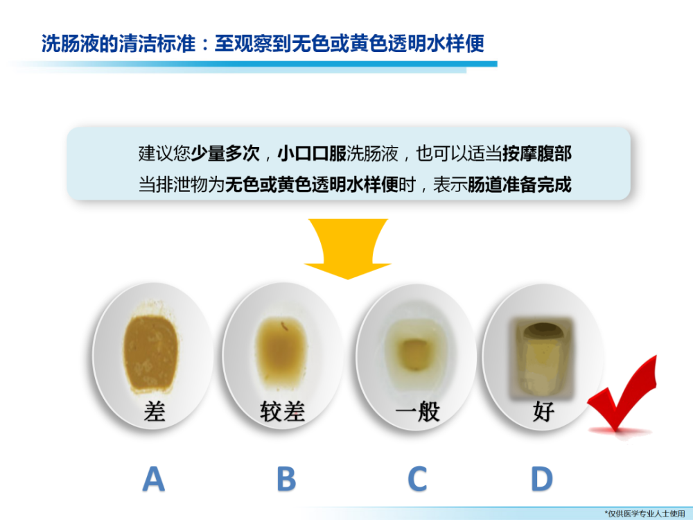 做肠镜检查前需要进行哪些准备?