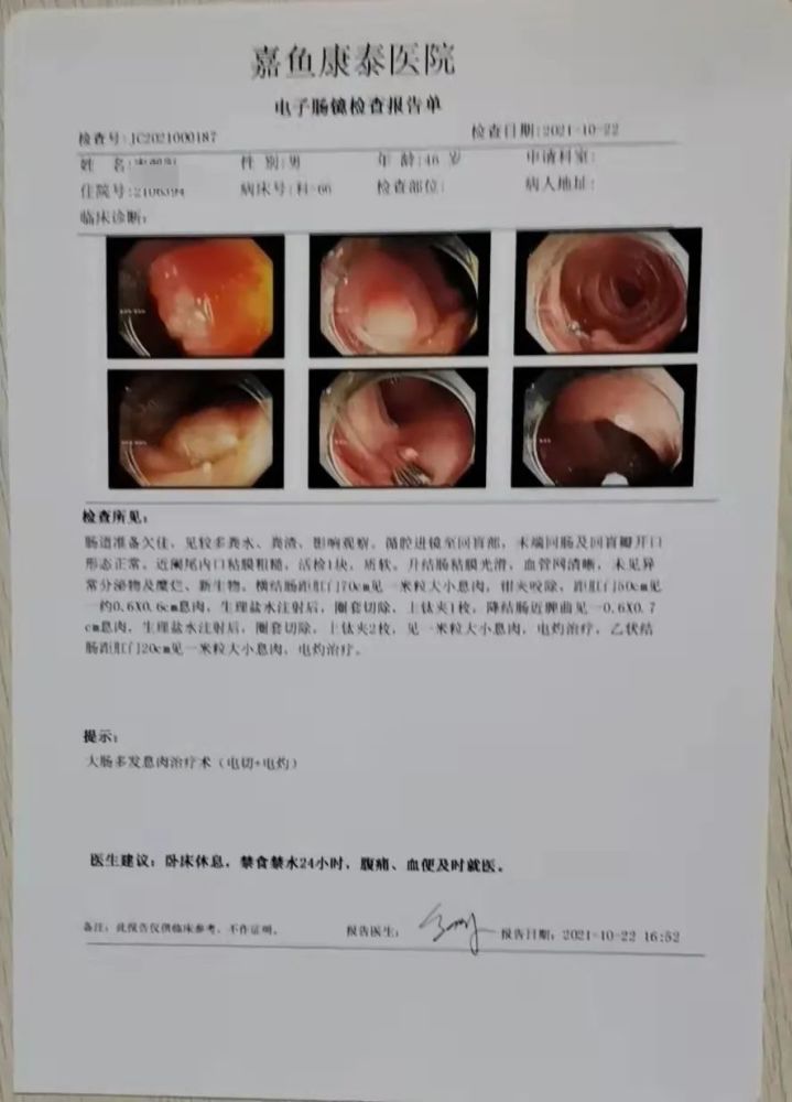 医讯【嘉鱼康泰医院】结肠多发息肉在无痛肠镜下实施电切电凝术一次