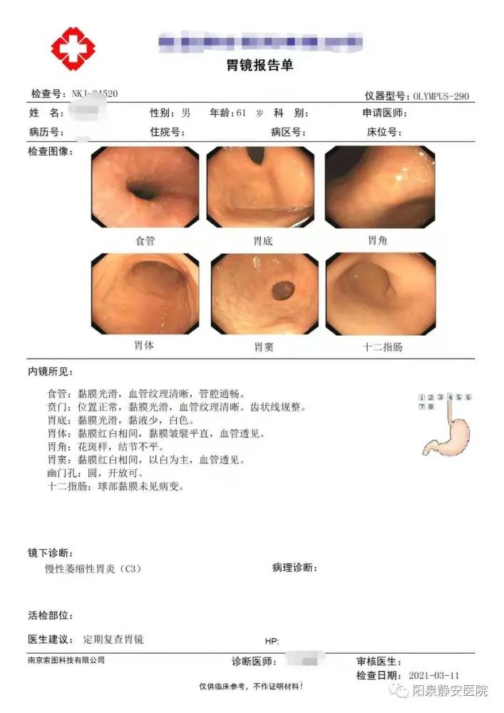 萎缩性胃炎可怕吗?