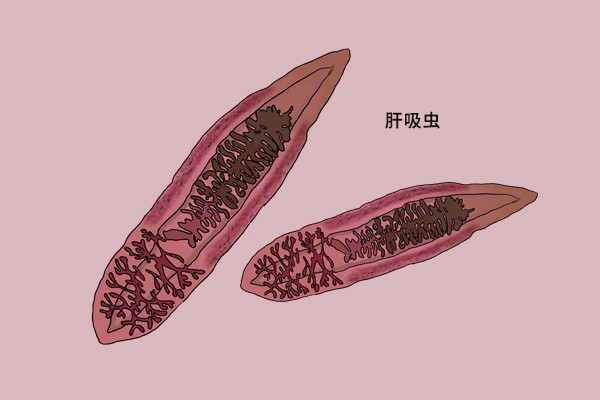 总出现畏寒,发热,检查出肝脏被"掏空",肝吸虫感染可不