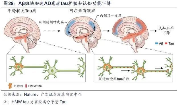 治疗阿兹海默症干细胞疗法展现积极潜力