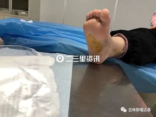 吉林市一女孩去温泉酒店洗澡脚被扎伤!三百多元医药费报销成难题?