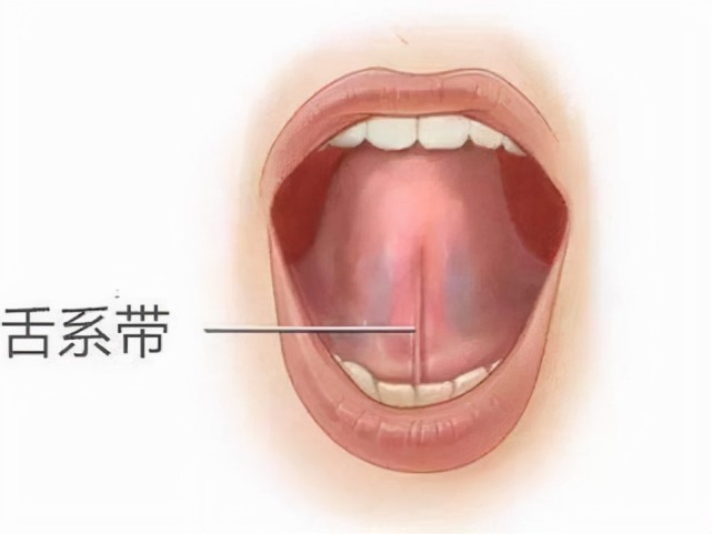 孩子舌系带短会影响他的说话吗?