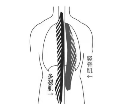 增强背部力量,缓解背部疼痛?竖脊肌锻炼可不能少!