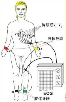 描记心电图时,在人体不同部位放置电极,通过这种心电图记录方法,以