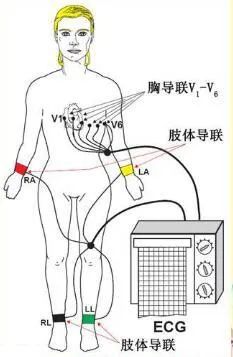 心电图讲解,心电图怎么看