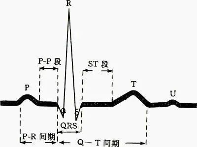 心电图讲解心电图怎么看