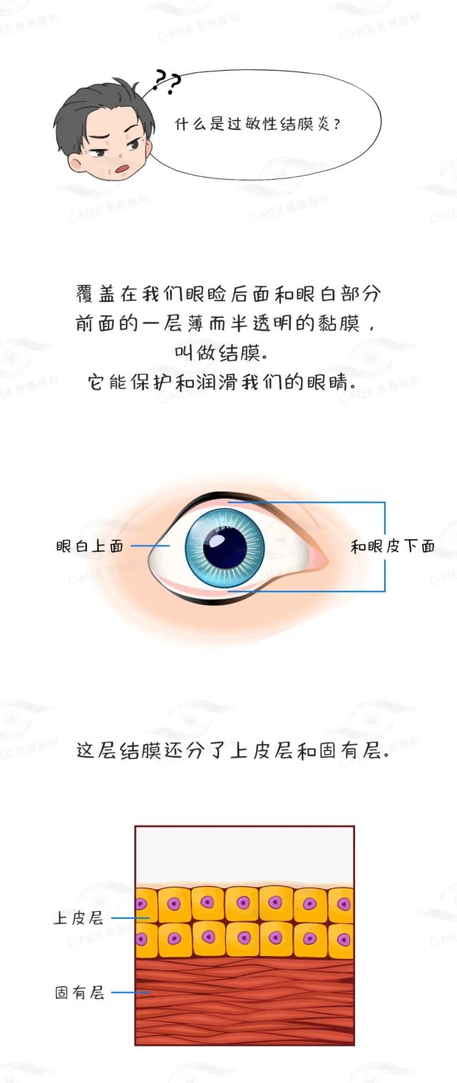 这个小儿常见眼病,该怎么防控?