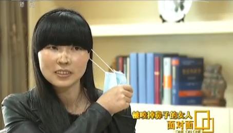 家暴中被咬掉鼻子的女人：在农村离婚很丢人 (图)