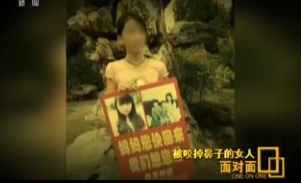 家暴中被咬掉鼻子的女人：在农村离婚很丢人 (图)