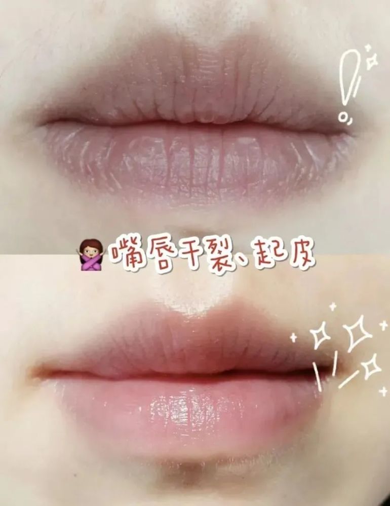 成语唇什么连_成语故事简笔画(5)