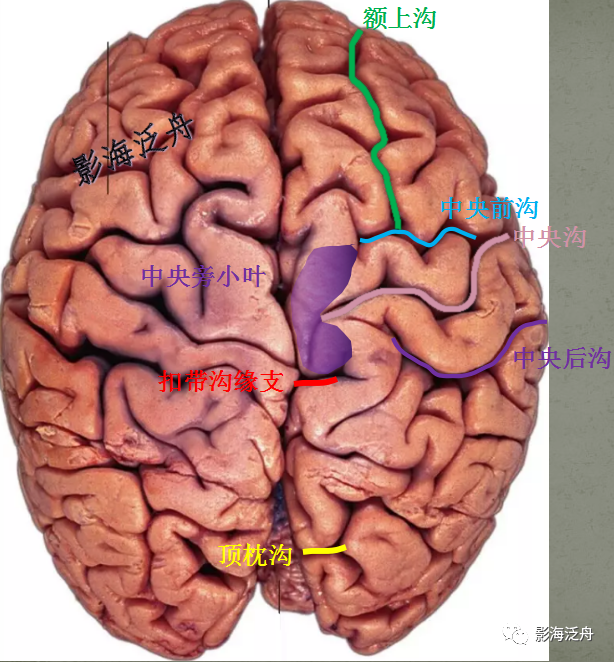 为了保证文章内容的准确性,本文对所有脑沟,脑回的解剖特征进行描述