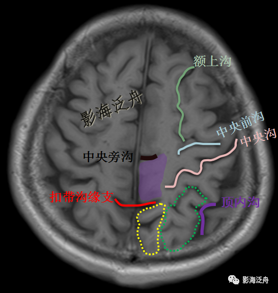 (4)额叶由额上沟,额下沟分为额上回,额中回,额下回三部分,其中额下回