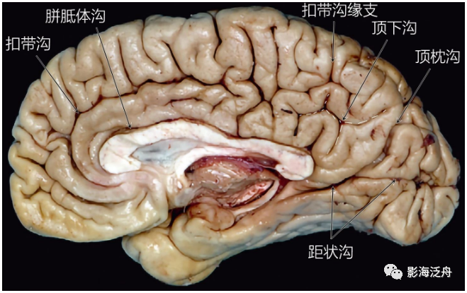 史上最详细的头颅mr解剖(一)