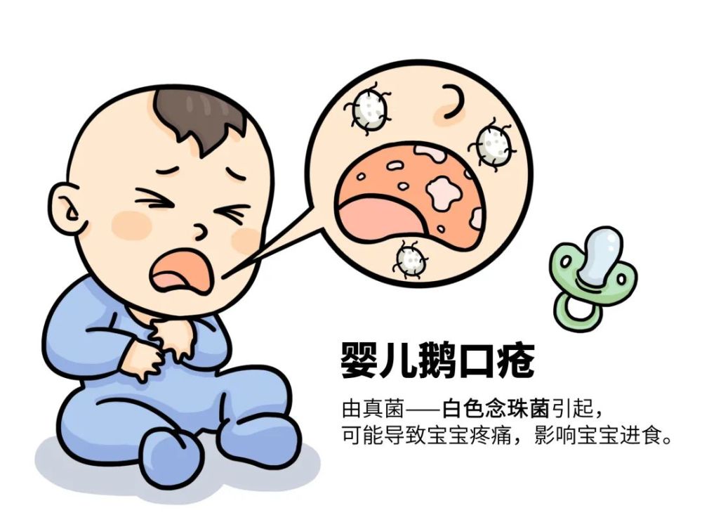 一些常见的疾病其实都是真菌在「捣乱」,比如足癣,婴儿鹅口疮,念珠菌