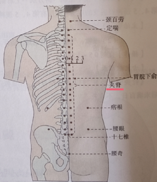 中医所言的夹脊穴是背腰部经外奇穴,并不是一个穴位点,它包括第一胸椎