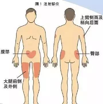 肌肉注射应该是90度进针;皮下注射是将药物注射到皮下组织内,进针角度
