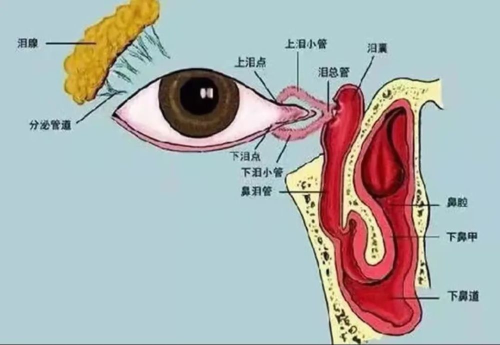 延安市人民医院耳鼻咽喉头颈外科完成一例高难度顽固性慢性泪囊炎手术