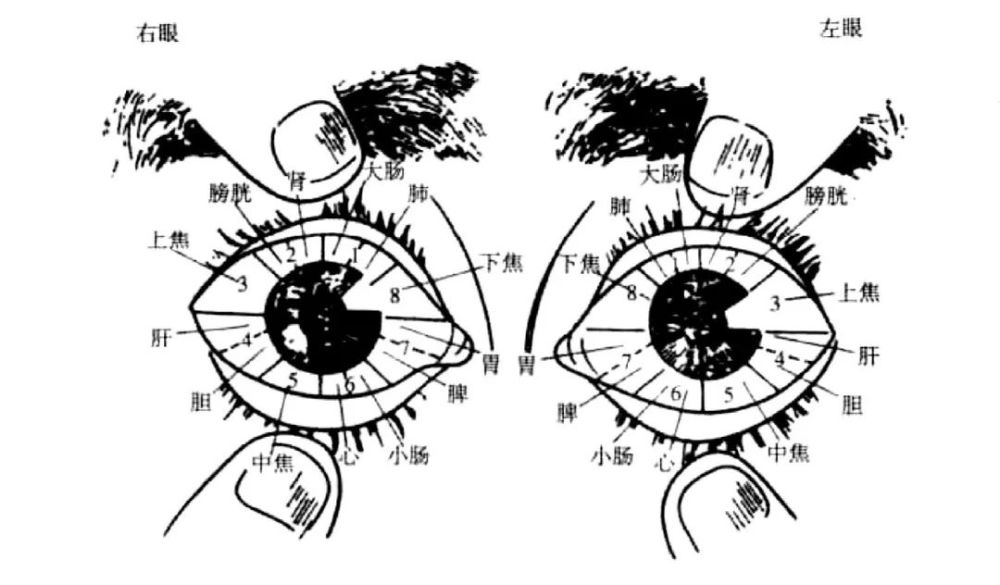 望诊一绝看眼睛的巩膜就知道病在什么地方