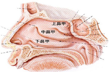 鼻甲肥大该怎么治