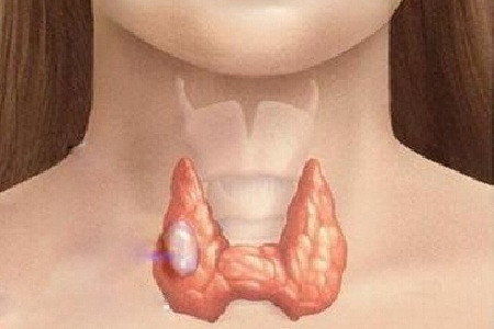 甲状腺是哪个部位 腾讯网