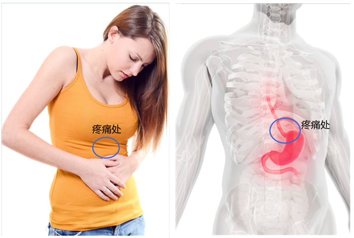 胃痛是什么感觉4种症状提示您可能存在胃病最大的祸根是幽门螺杆菌孔
