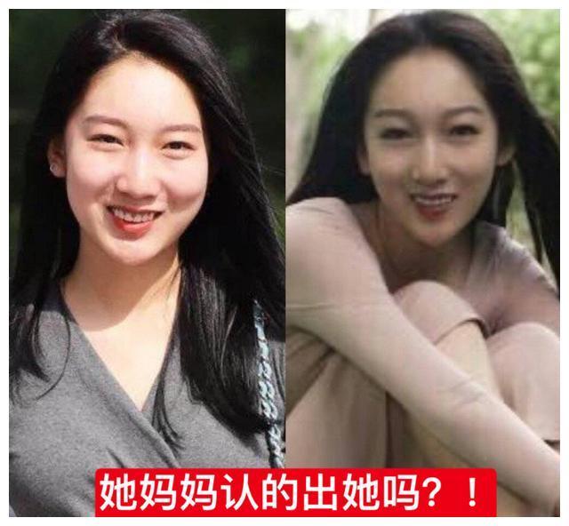 疑似都美竹整容前照片曝光,和现在的颜值对比,你们觉得怎么样?