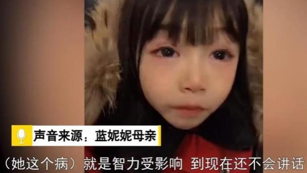 "无声天使"蓝妮妮:患罕见基因病,拥有超高颜值却无自理能力
