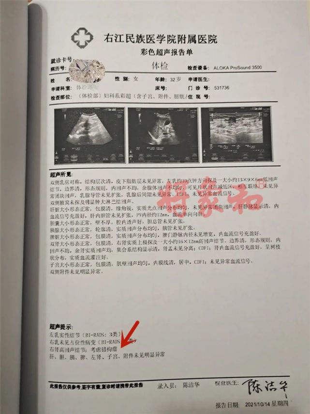 我灸好了:肾囊肿