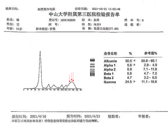 图1 血清蛋白电泳检查报告图2患者血清毛细管法免疫分型固定电泳图图