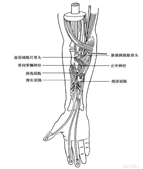 骨头之间)起自正中神经是指正中神经和骨间掌侧神经在前臂近侧受压后