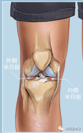 膝关节半月板损伤