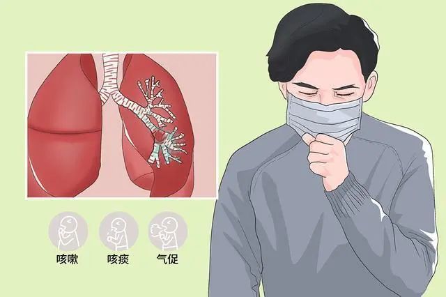 【肺癌关注月】肺癌症状不一定表现在肺部,其临床表现有哪些?