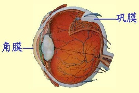 巩膜外层炎有哪些典型症状|巩膜|结节|结膜|巩膜炎|自限性|水肿|表层