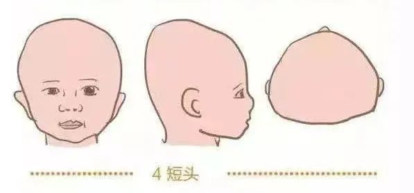 只要记住,如果宝宝睡姿良好,没有长期侧睡,但还是长了一颗又窄又长的