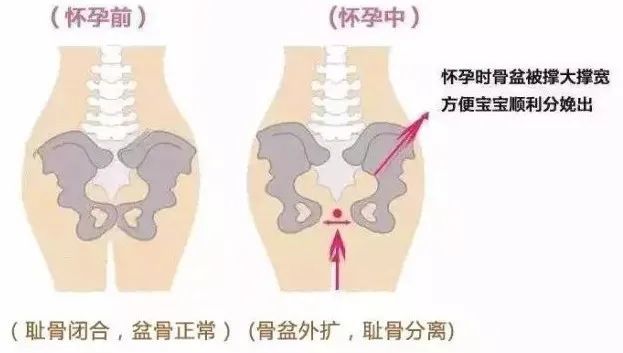 怀孕后由于内分泌改变,产妇的韧带变松弛,耻骨联合会轻度分离,为的是