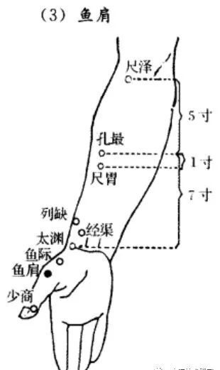 肩周炎的针灸调理