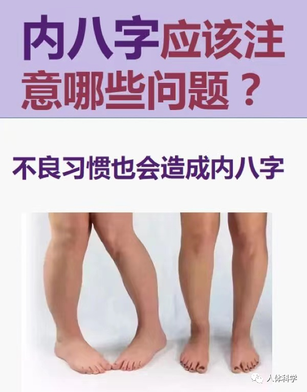 儿童体态不良习惯导致内八字改善方法