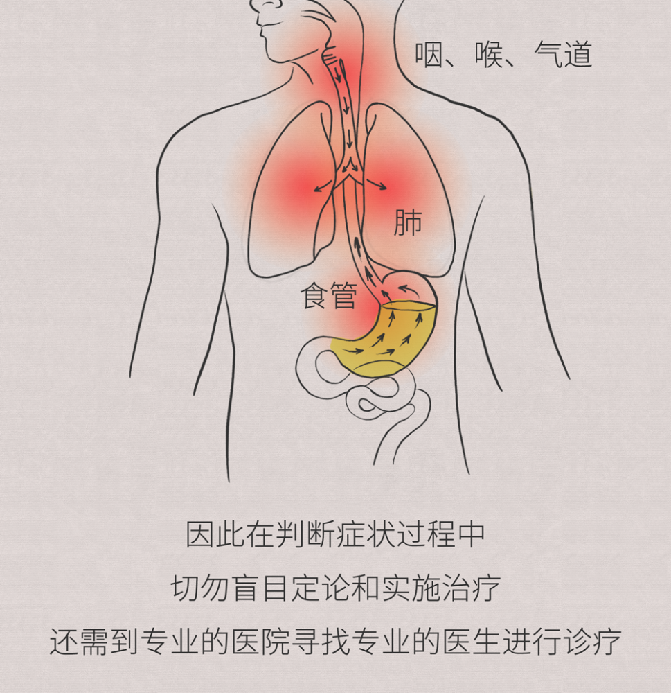 烧心反酸,这种疾病可不是你想的那么简单!