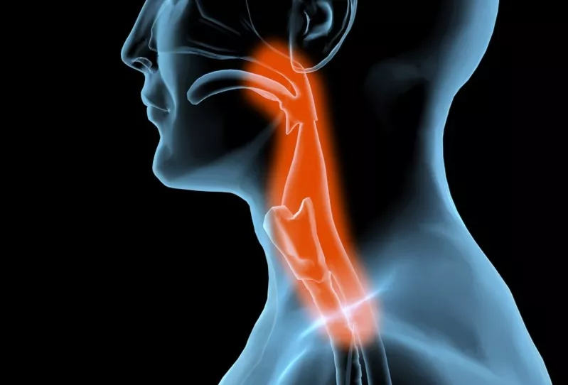 咽喉炎是临床上的常见病和多发病,有急,慢性之分,属于上呼吸道感染的