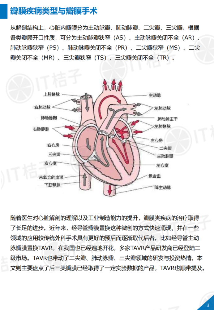 医疗器械投资正热,我们研究了国内外最值得关注的心脏瓣膜置换产品
