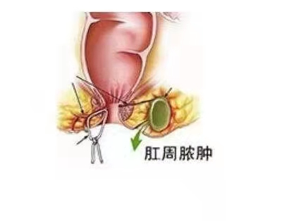 肠道的作用,保障便便能顺畅通过,但如果大便稀或者掉入排泄物残渣时