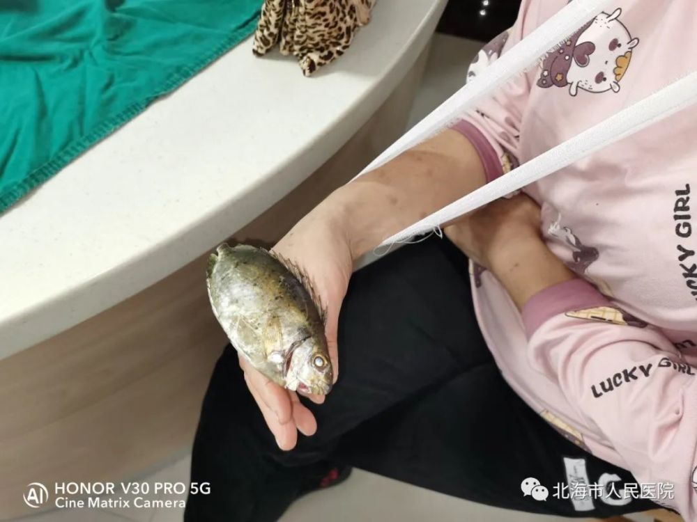 当时8时许,陈女士右手"顶"着这条泥猛鱼来到了市人民医院银滩院区急诊