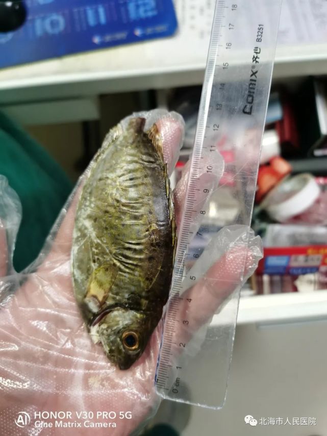 伤人的泥猛鱼赖泳成介绍,他轮转到急诊科工作两个月期间,接诊过数例被