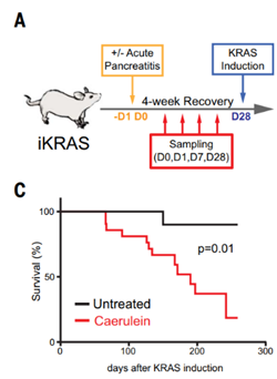 的炎症反应还会诱发腺泡导管化生(as acinar-to-ductal metaplasia